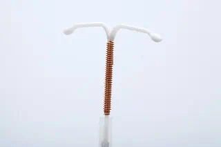 Copper IUD or Paraguard