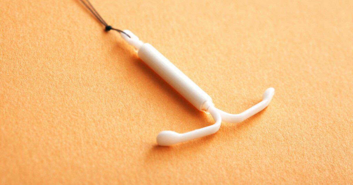 The Pros And Cons Of Hormonal Iuds Mirena Kyleena And Skyla 7707