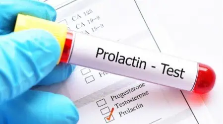 Prolactin blood test.